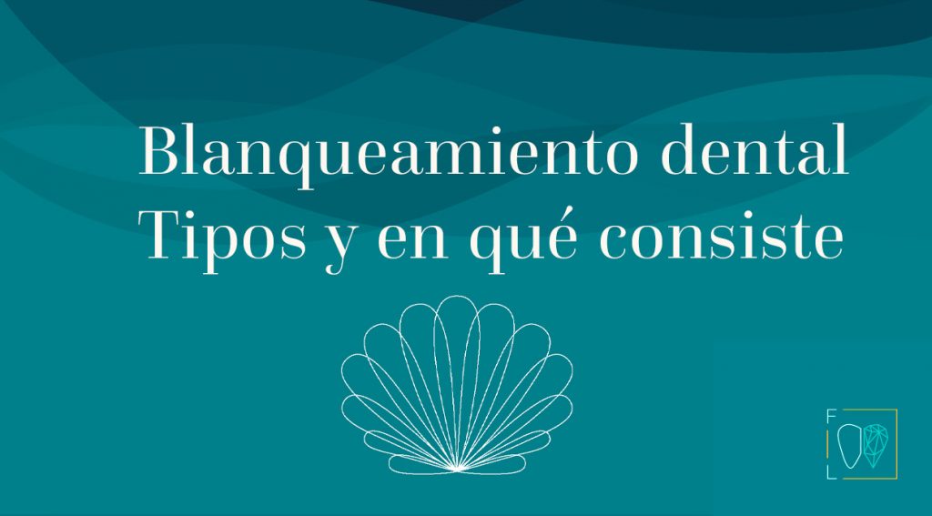 blanqueamiento dental