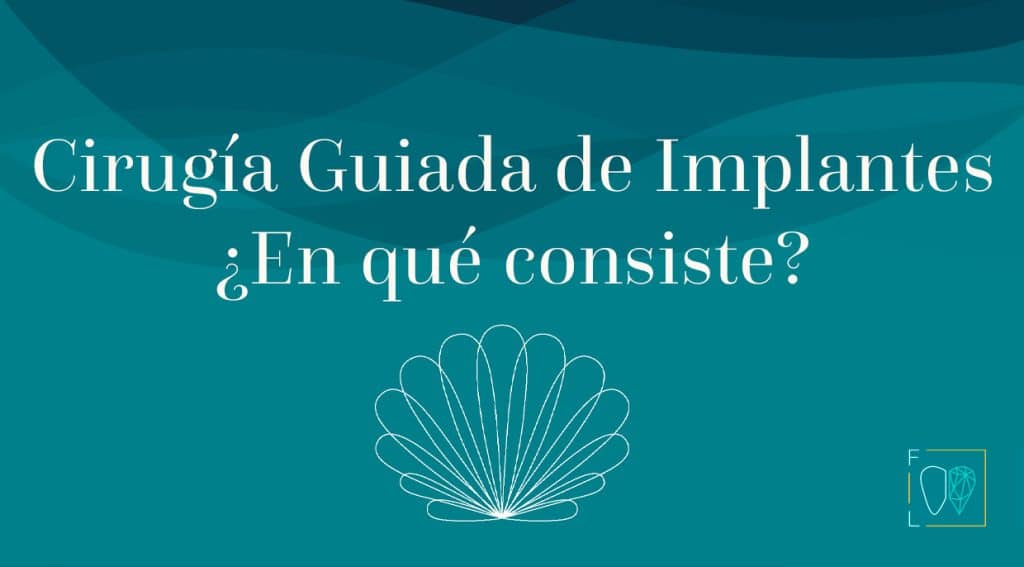 cirugia guiada implantes