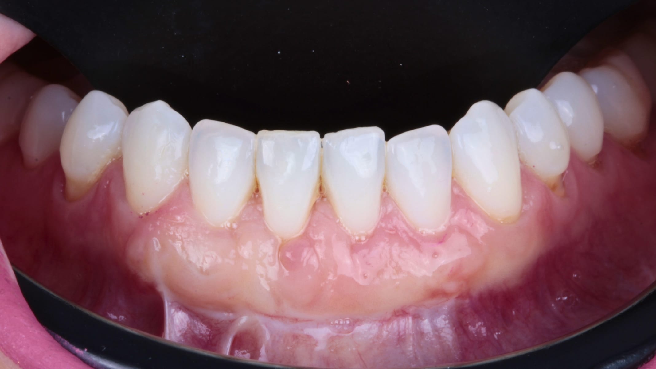 Periodoncia después 1