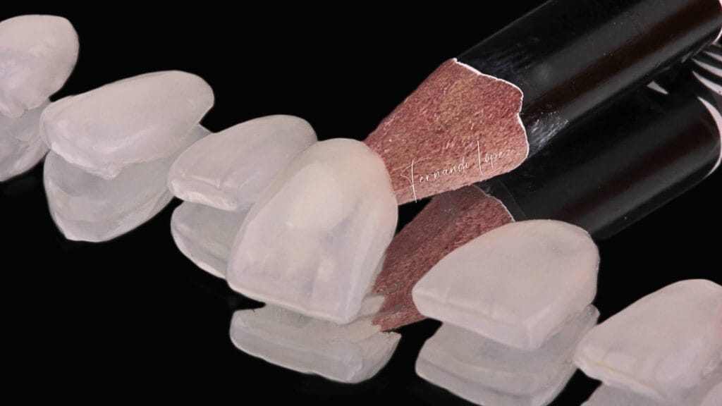 Carillas de disilicato de litio FL Dental