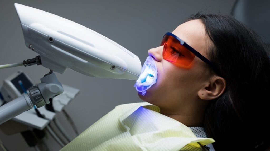 Blanqueamiento dental FL Dental