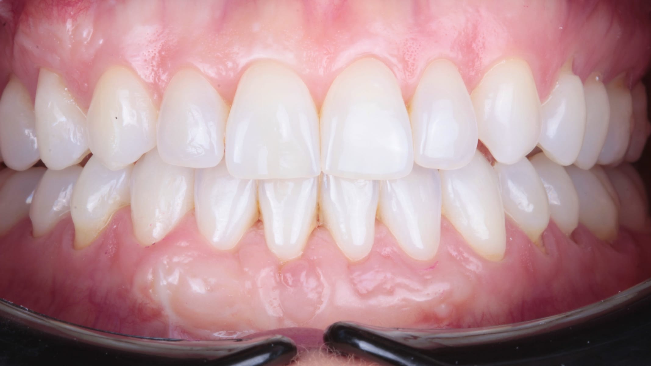 Periodoncia después 2