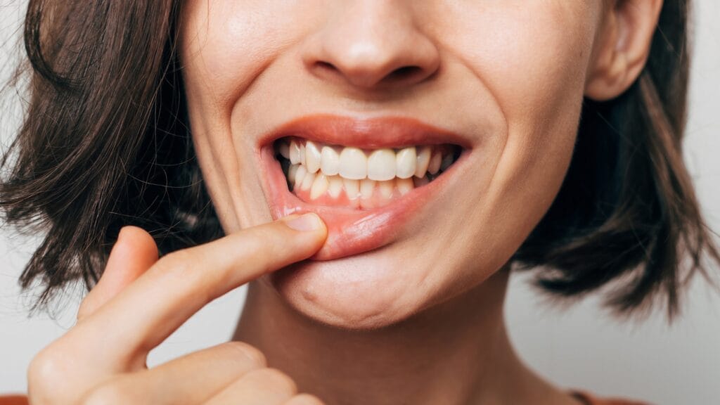 Periodoncia FL Dental 1