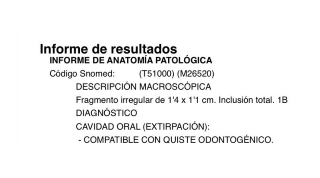 quiste asociado al diente 6