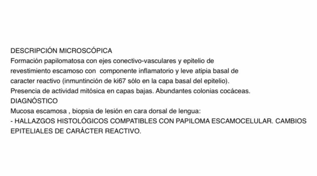 papiloma2